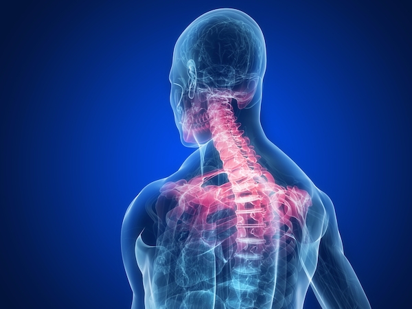 Apakah nyeri otot leher merupakan penyakit yang berbahaya